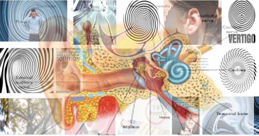 VERTIGO PERIFER  (Benign Paroxysmal Positional Vertigo (BPPV))