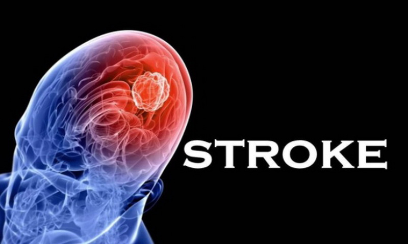 Mengenal Stroke dan Pencegahannya